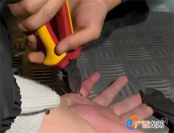 消防员偷戴女友戒指被卡 戒指卡手指会对身体造成危害吗
