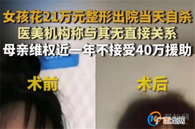 女孩花21万整形出院当天跳河自杀 整形失败如何维权