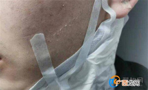 高中生疑遭同学群殴被逼喝尿 校园霸凌的影响