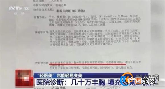 女子丰胸检出骆驼等动物源性成分 丰胸的危害